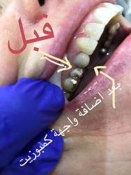 عيادة أسنان دكتور ياسر محمد مبارز اللاسلكي المعادى