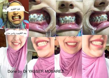 عيادة أسنان دكتور ياسر محمد مبارز اللاسلكي المعادى